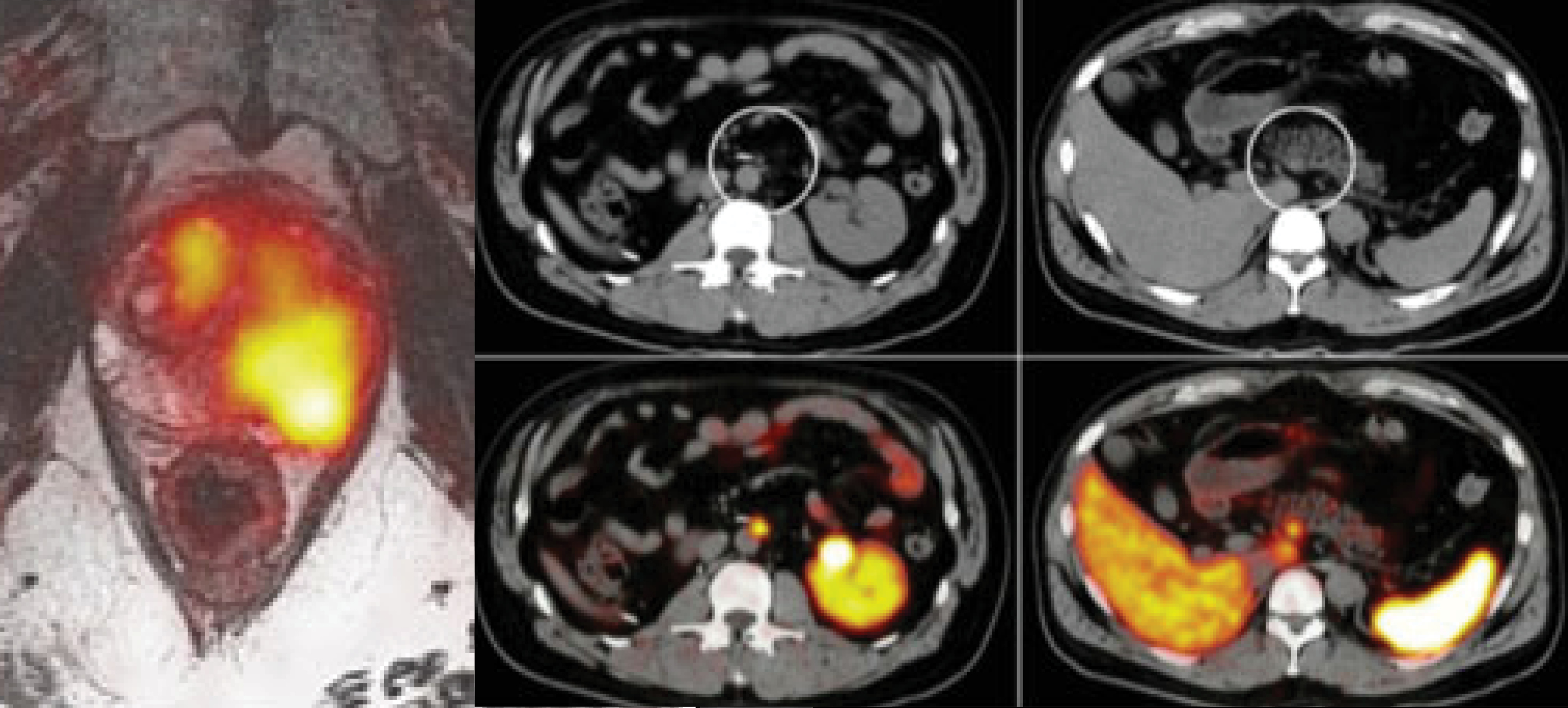 Series of PET and MRI fusion images showing radiotracer uptake in different body regions, illustrating metabolic activity and imaging contrast used in molecular imaging and radiochemistry research.