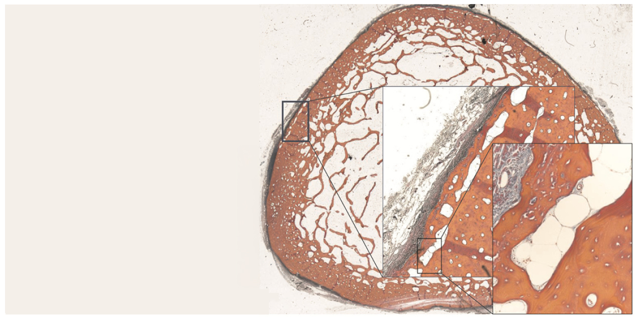 Histologic cross section of bone showing intracortical vascular networks, with inset magnifications highlighting blood vessels within cortical bone tissue.