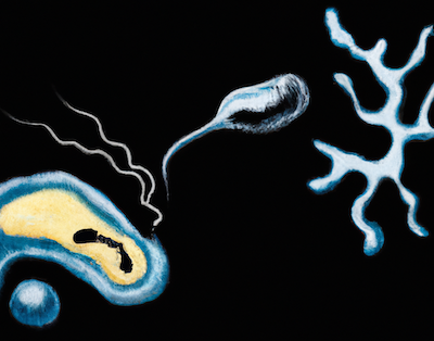 DALL·E 2023-04-16 20.24.02 - generate a dali style image on Parkinson's Disease brain and alpha-synuclein (1) copy.png