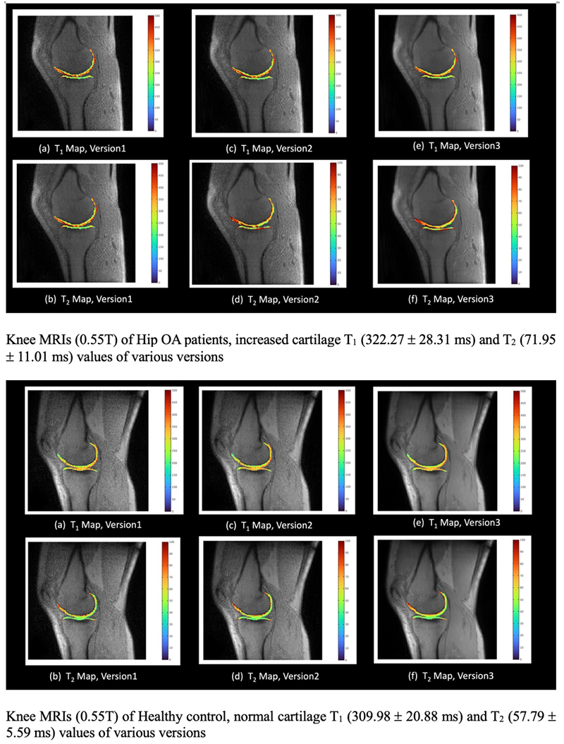 Knee-biomarkers-Low-field-3.jpg
