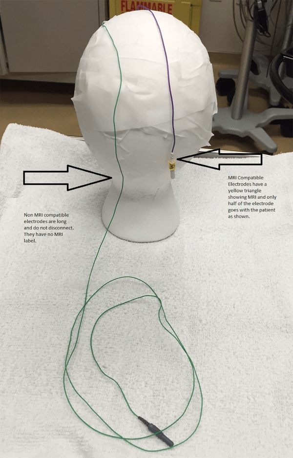 MRI Compatible versus Non-Compatible Electrodes.