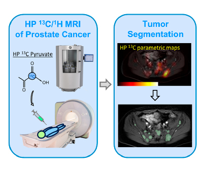 Whole abdominopelvic HP 13C metabolic MRI using cutting-edge techniques. Figure 1.