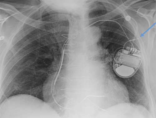 Abanded&nbsp;leads plus generator