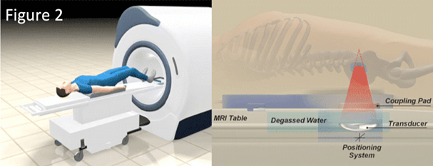 bone-metastasis-us-2
