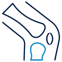 Image of bone and knee