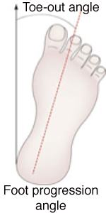 Illustration of a foot showing the toe out angle and foot progression angle, demonstrating how foot orientation is measured during walking.