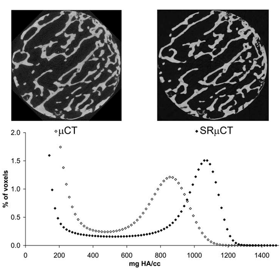 Comparison of trabecular bone images acquired with micro CT and synchrotron radiation micro CT, with a graph showing differences in voxel mineral density distributions between the two imaging methods.