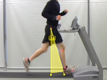 Side view of a runner on a treadmill with motion capture markers and a highlighted triangular overlay showing overstride angle at foot contact.