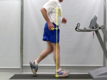Side view of a person walking on a treadmill with motion capture markers and a vertical reference line illustrating normal stride length and foot placement.