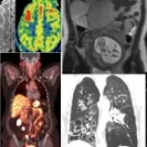 Collage of medical imaging scans from MRI, CT, PET, and angiography