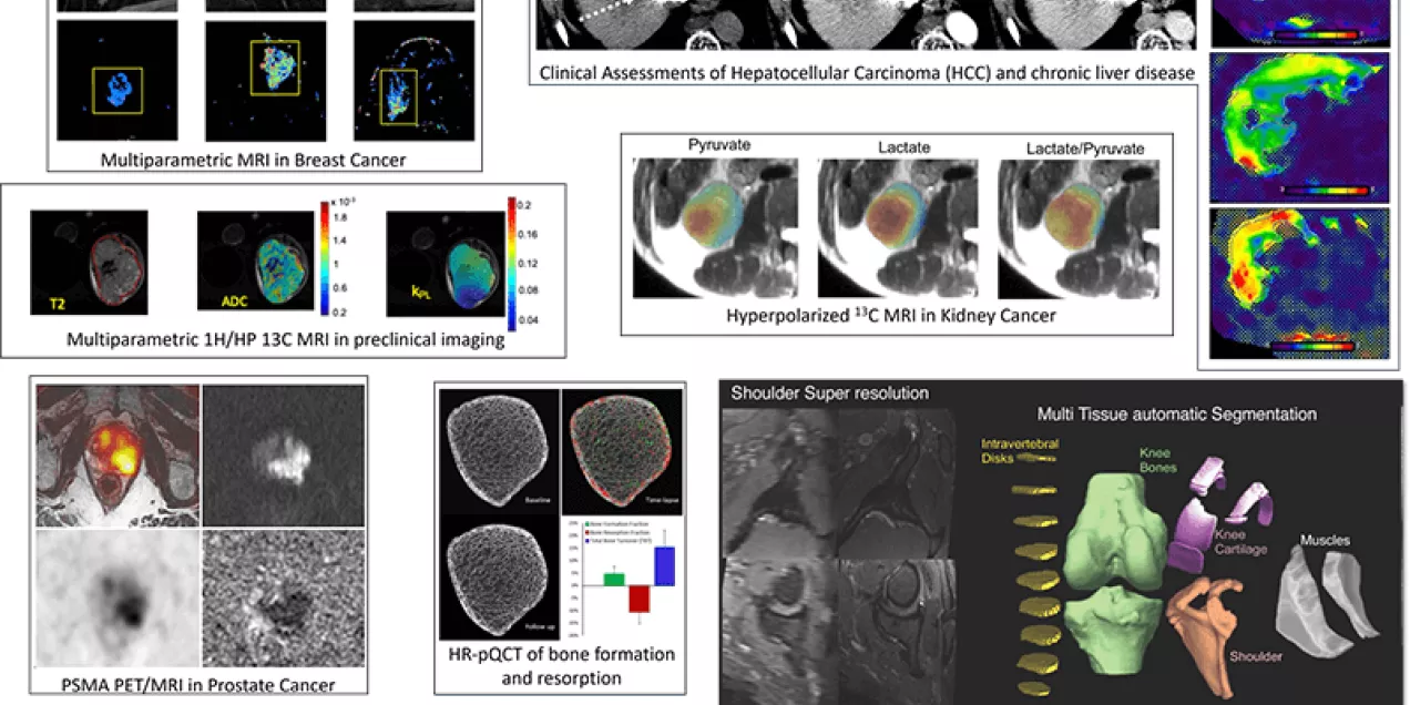 UCSFBodyImagingResearch-research_2024rev04.15-1 (2).jpg