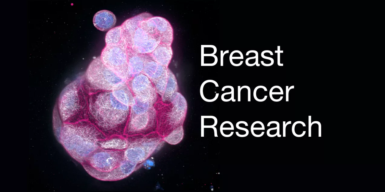 3D medical visualization of a breast tissue structure rendered in vivid pink and blue tones against a black background, representing breast cancer research. To the right, white text reads “Breast Cancer Research.”