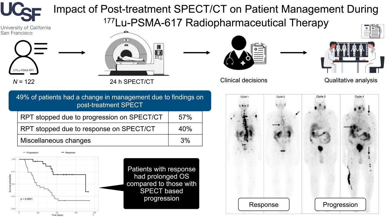 Impact of post-treatment SPECT/CT