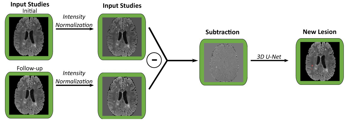 MS lesion detection graphic
