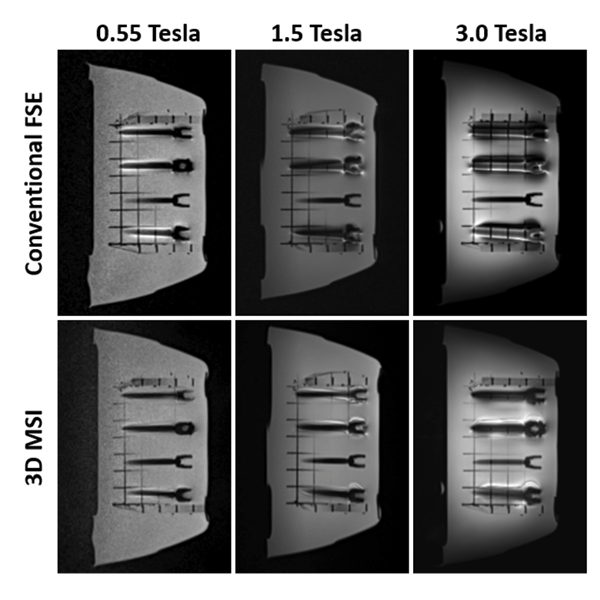 multiple MRI scanned images