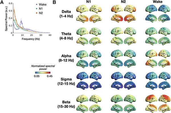 Graphs of brain activity