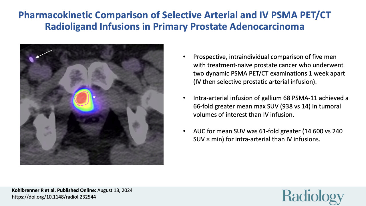 Pharmacokinetic comparicon of selective aterial andIV PSMA PET/CT radioligand infusions